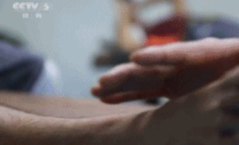 广厦队医介绍苏若禹的治疗方案:治疗师发功治病,你怎么看 - 体育赛事直播